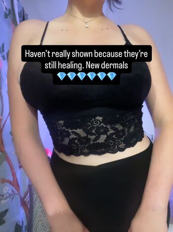 🔥 Adept leaked private photo uncensored full