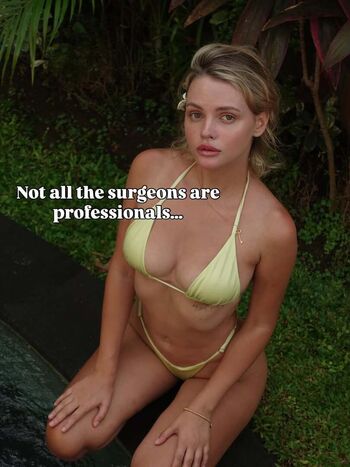 🔥 Angelsetfree page leaked private photo uncensored full