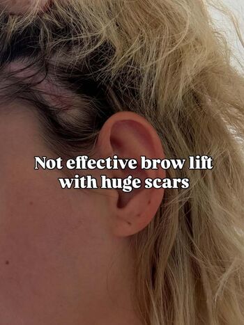 🔥 Angelsetfree page leaked private photo uncensored full