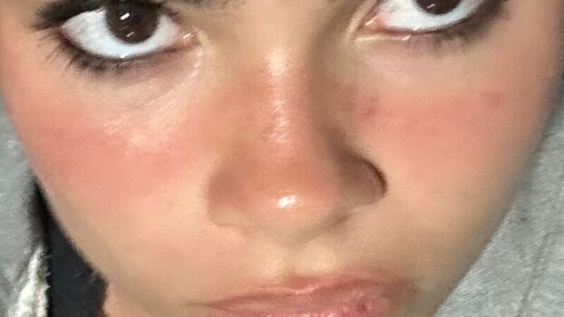 🔥 Ariana greenblatt page leaked private photo uncensored full