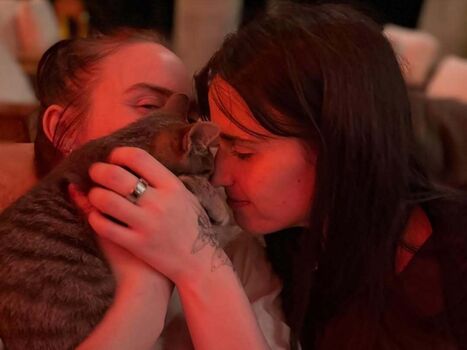 🔥 Billie eilish  page leaked private photo uncensored full