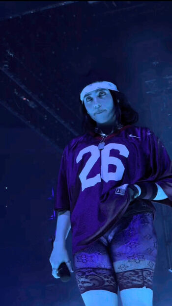 🔥 Billie eilish  page leaked private photo uncensored full