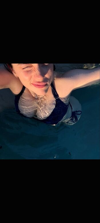 🔥 Billie eilish  page leaked private photo uncensored full