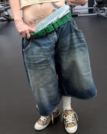 🔥 Billie eilish  page leaked private photo uncensored full