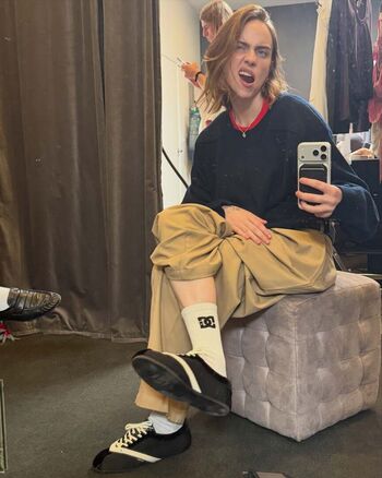 🔥 Billie eilish  page leaked private photo uncensored full