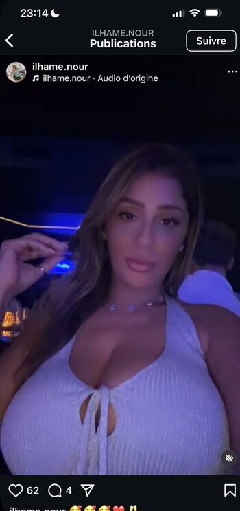 🔥 Bysouk page leaked private photo uncensored full