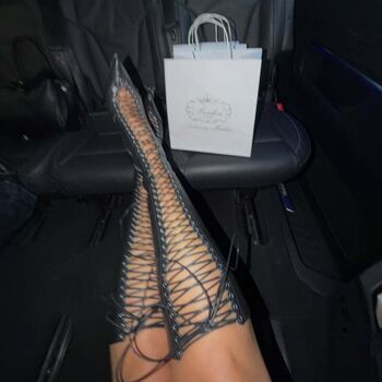 🔥 Dua lipa  page leaked private photo uncensored full