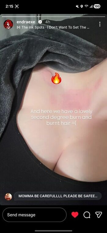 🔥 Endra exe leaked private photo uncensored full