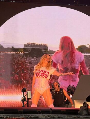 🔥 Kesha leaked private photo uncensored full