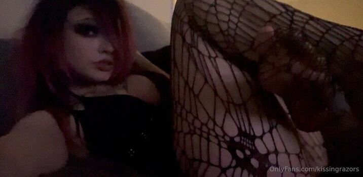 🔥 Killkels page leaked private photo uncensored full