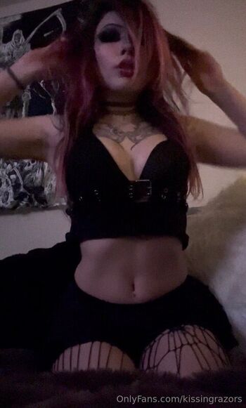 🔥 Killkels page leaked private photo uncensored full