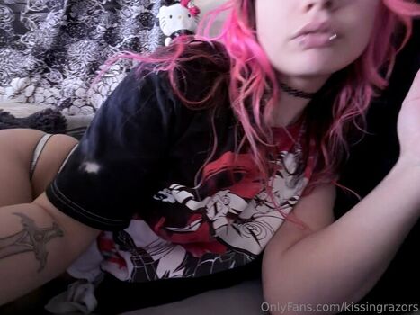 🔥 Killkels page leaked private photo uncensored full