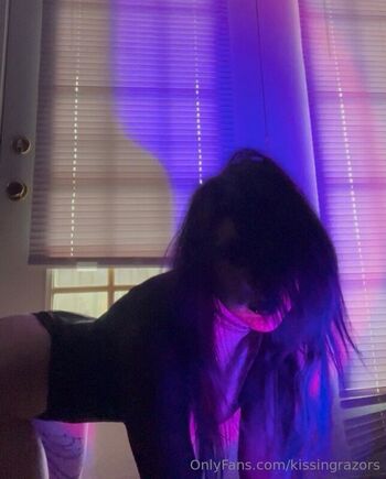 🔥 Killkels page leaked private photo uncensored full