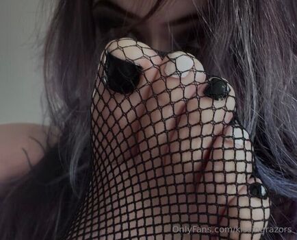 🔥 Killkels page leaked private photo uncensored full