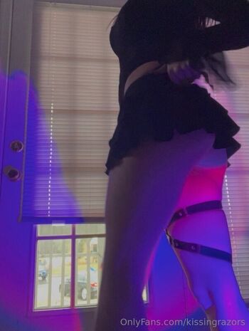 🔥 Killkels page leaked private photo uncensored full