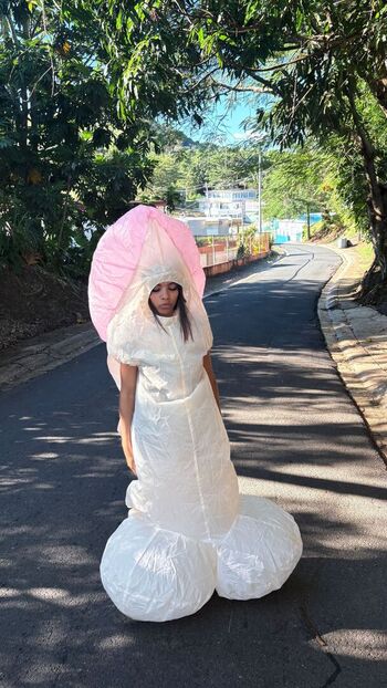 🔥 Tubbbbss  page leaked private photo uncensored full